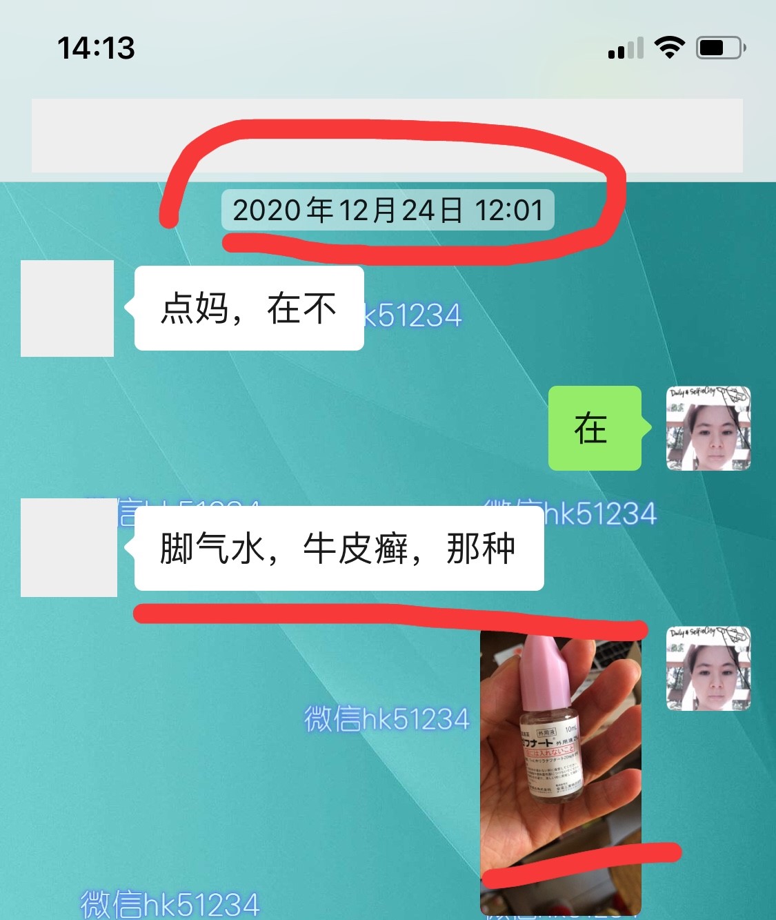 脚气烂脚趾缝痒溃烂怎么治